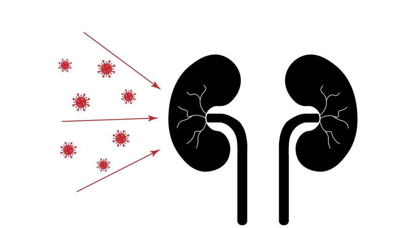 Viêm cầu thận sau nhiễm trùng (PIGN) là gì? Nguyên nhân, triệu chứng và cách điều trị 5