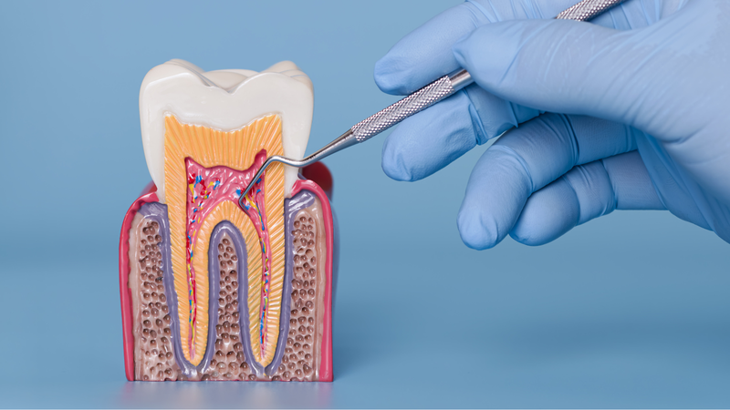 Viêm chân răng uống thuốc gì?