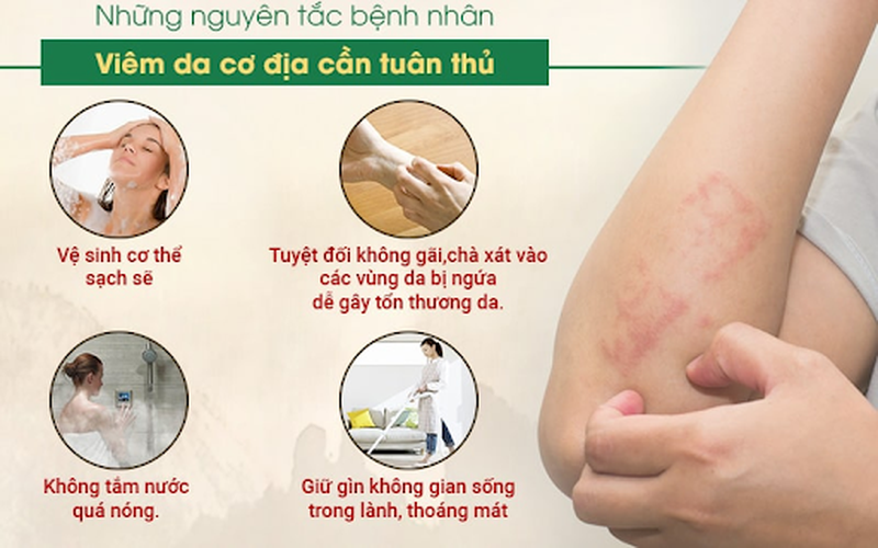 Viêm da cơ địa kiêng gì trong sinh hoạt hàng ngày.