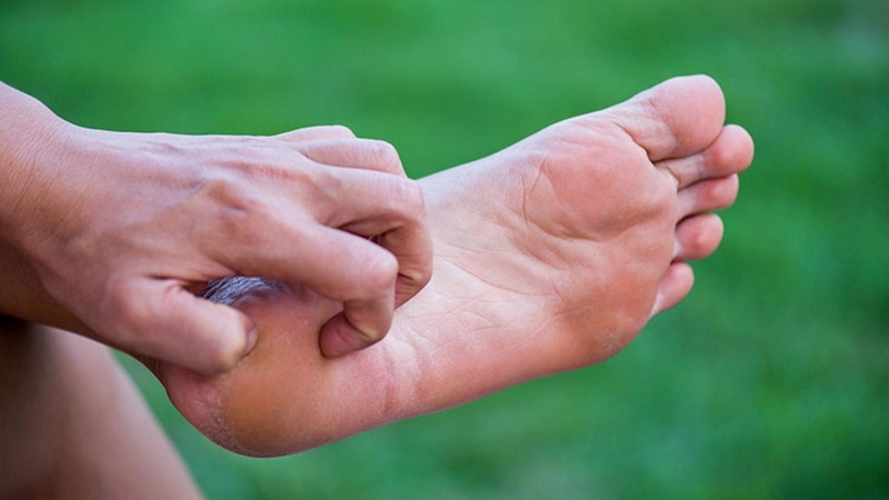 Viêm da cơ địa ở chân là gì? Cách nhận biết và điều trị bằng Đông y 1