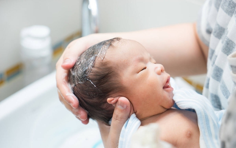 Viêm da tiết bã ở trẻ sơ sinh: Triệu chứng và cách điều trị 2