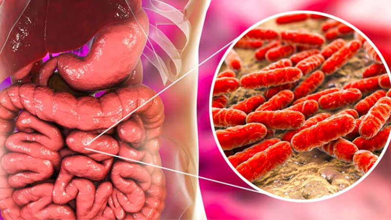 Viêm đại tràng vi thể là bệnh gì? Nguyên nhân và cách điều trị 1