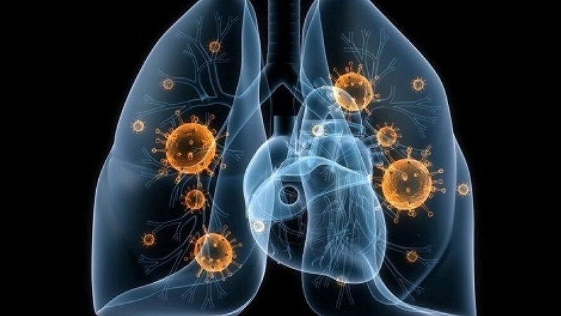 Viêm dây thần kinh cấp tính nguyên phát: Nguyên nhân, triệu chứng và điều trị 1