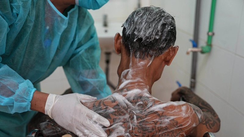 Viêm dây thần kinh ngoại biên: Nguyên nhân và triệu chứng gây bệnh 3