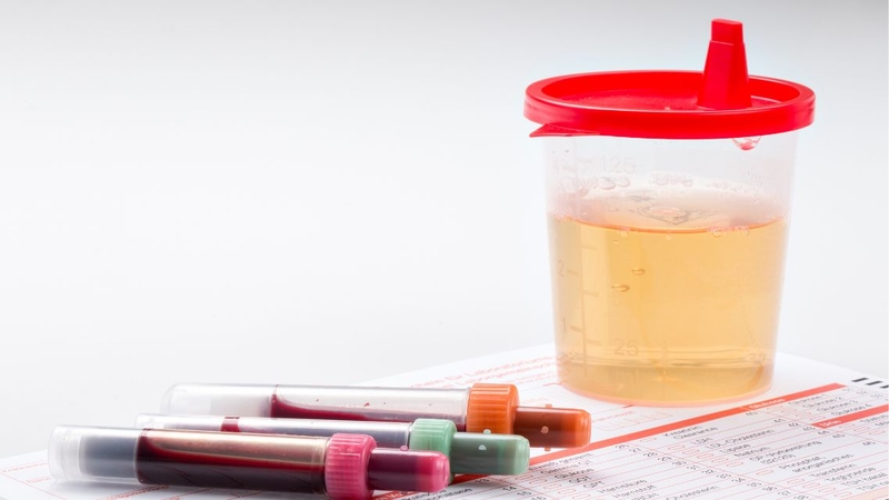 Viêm đường tiết niệu kèm tiểu ra máu cần được điều trị đúng nguyên nhân