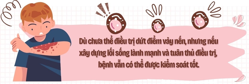 Vảy nến không chỉ là bệnh ngoài da: Đừng bỏ qua những tổn thương bên trong cơ thể! 9