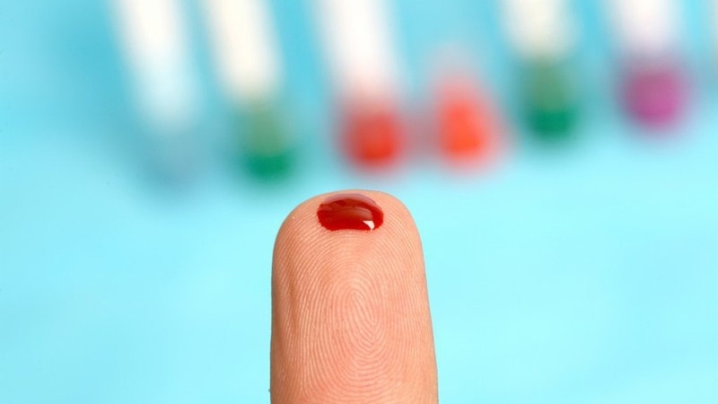 Viêm gan B có lây không? Bệnh viêm gan B lây qua đường nào phổ biến