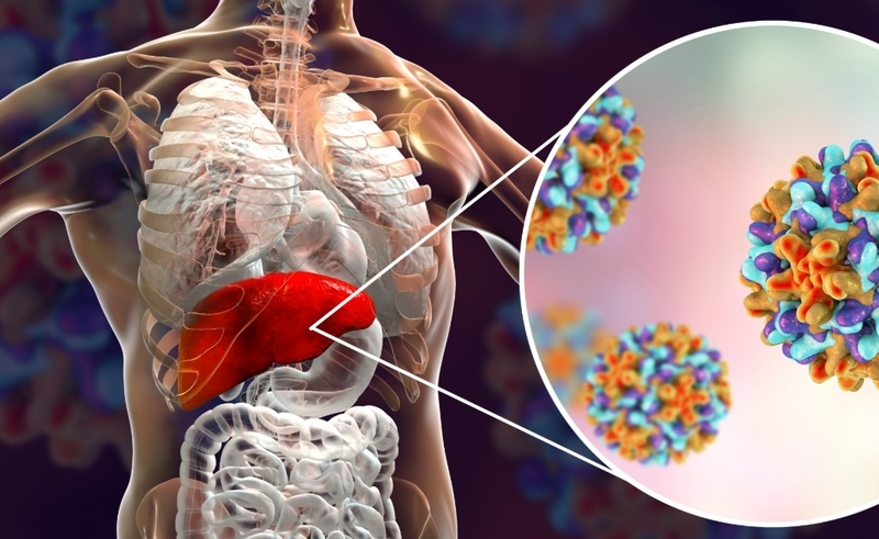 Viêm gan B là bệnh gì và viêm gan B có lây qua đường nước bọt không? 3