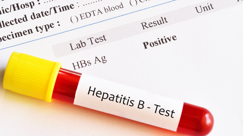 Viêm gan B lây qua đường gì? Biện pháp phòng ngừa lây nhiễm viêm gan B 1