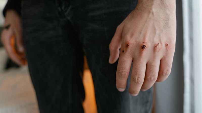 Virus viêm gan B lây khi máu của người nhiễm tiếp xúc với vết thương hở của người lành