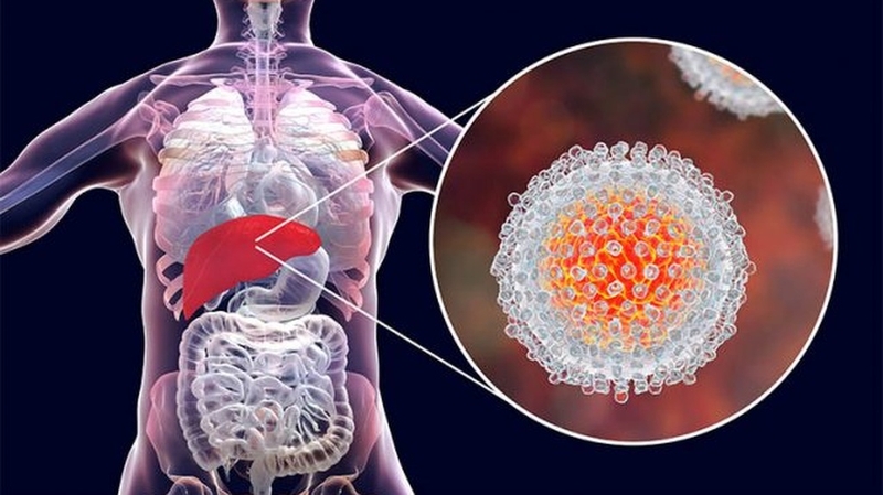 Viêm gan C có tự khỏi không? Hiểu rõ về bệnh và các phương pháp điều trị 2