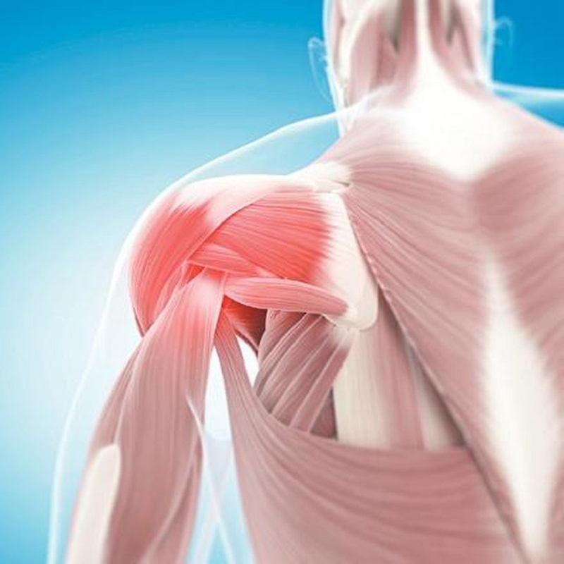 Viêm gân cơ trên gai: Nguyên nhân, triệu chứng, chẩn đoán và điều trị 2