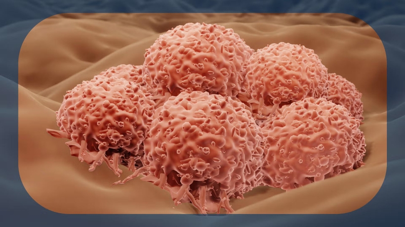 Viêm gan G là gì? Nguyên nhân, triệu chứng và cách điều trị 4