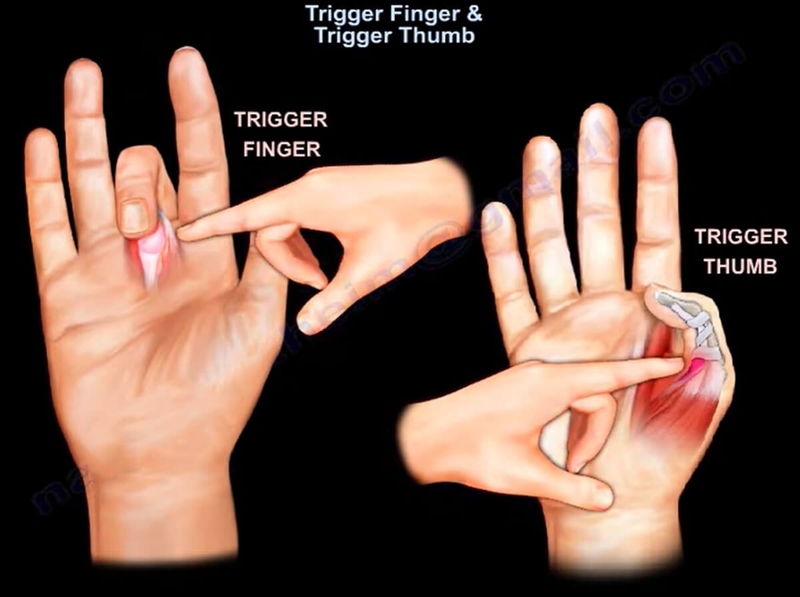 viem-gan-gap-ngon-cai 4.jpg