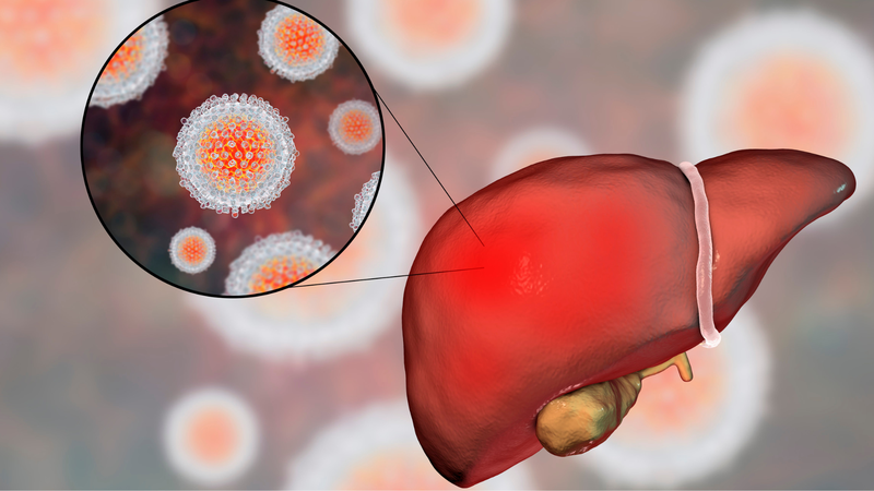 Viêm gan siêu vi B là bệnh gì? Các con đường lây truyền của bệnh 1