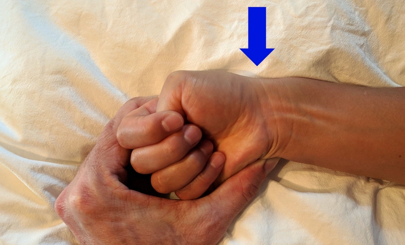 Viêm gân vùng mỏm trâm quay cổ tay do nguyên nhân gì? Cách phòng bệnh hiệu quả 1