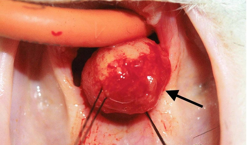 Viêm họng hạt có tự khỏi không và cách phòng ngừa 2
