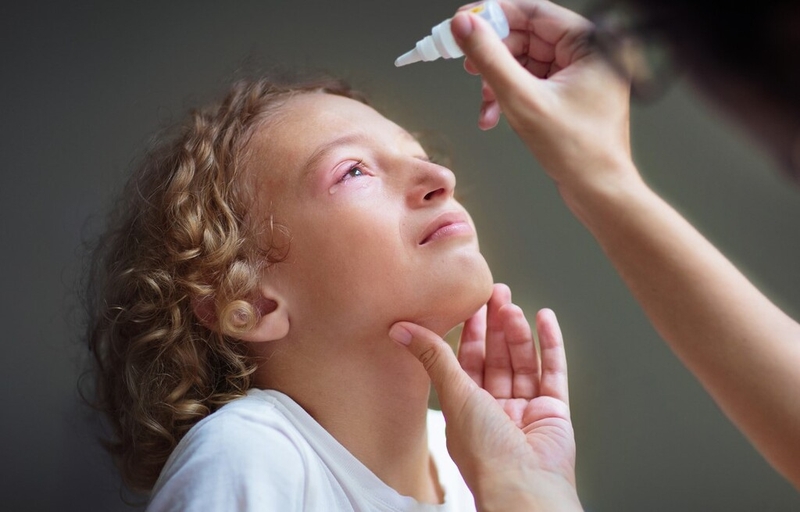 Viêm kết giác mạc cấp: Nguyên nhân, triệu chứng, chẩn đoán và điều trị 4