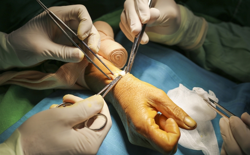 Viêm khớp cổ tay là gì? Viêm khớp cổ tay có nguy hiểm không?3