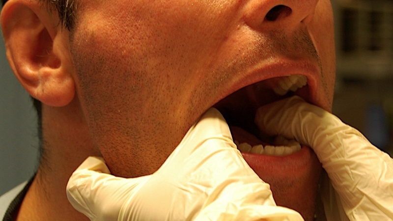 Bị viêm khớp thái dương hàm khám ở đâu? 1