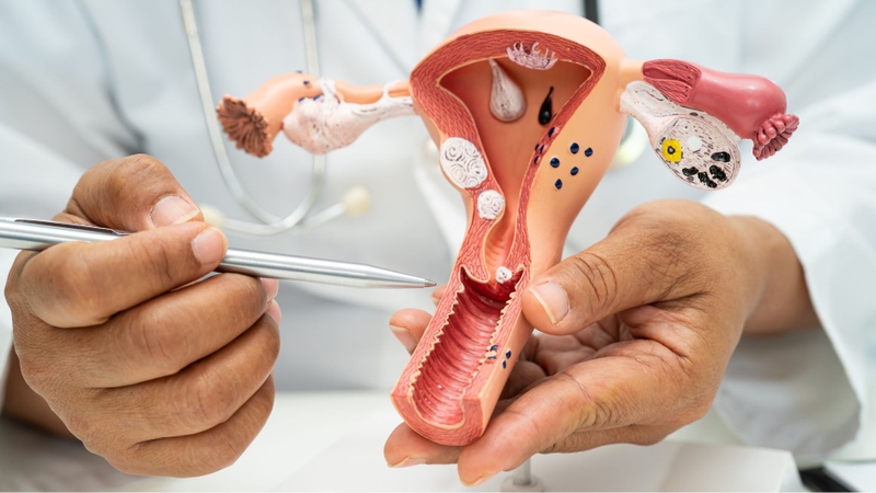 Viêm lộ tuyến 1cm thường kiểm soát tốt khi điều trị