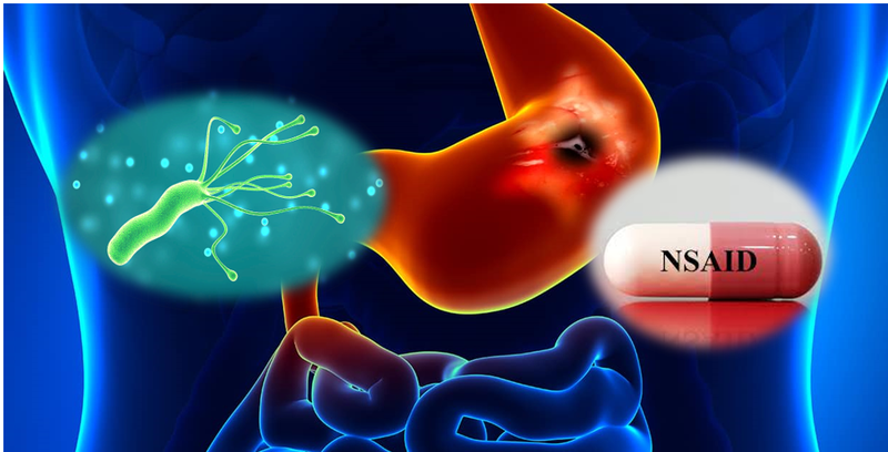 Viêm loét bờ cong nhỏ dạ dày nguy hiểm như thế nào? 5