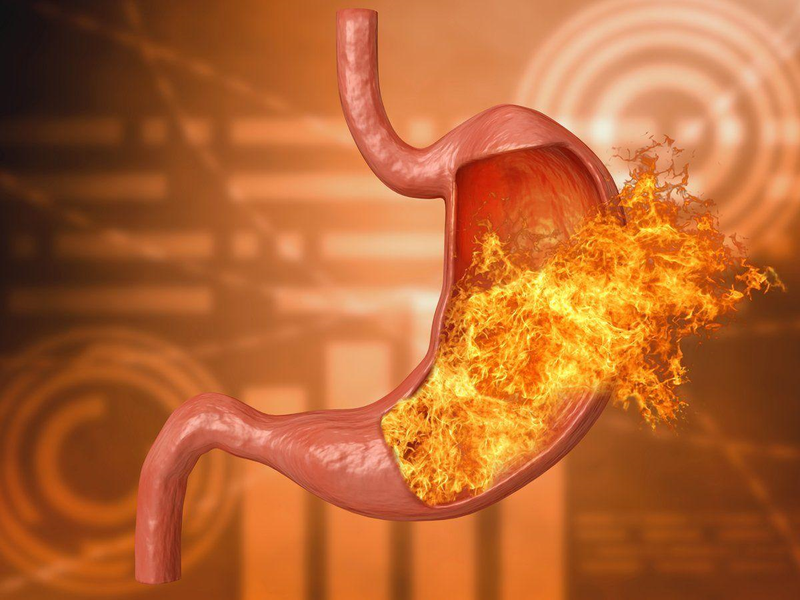 Viêm loét dạ dày, tá tràng và 5 thói quen tốt cần thực hiện ngay