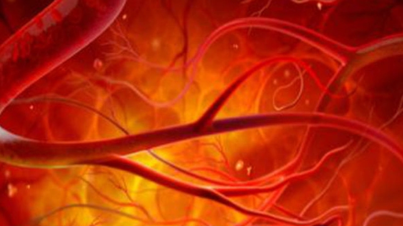 Viêm mạch máu là gì? Nguyên nhân và cách điều trị bệnh 3