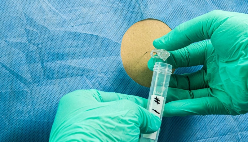 Viêm màng não do Hib: Triệu chứng và phương pháp điều trị hiệu quả 3