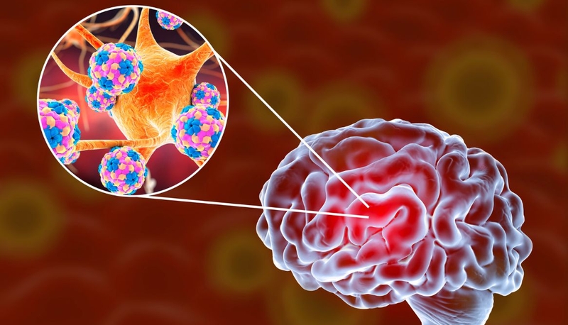 Phân biệt viêm màng não do mô cầu và viêm màng não khác 1