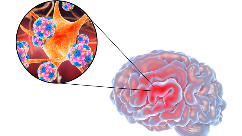 Viêm màng não mô cầu có lây không? Biện pháp phòng bệnh viêm màng não mô cầu 1