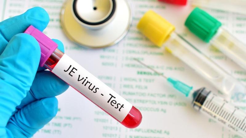 Viêm màng não và viêm não Nhật Bản khác nhau thế nào 1