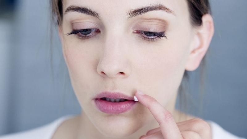 Viêm môi dạng u hạt là bệnh gì? 4