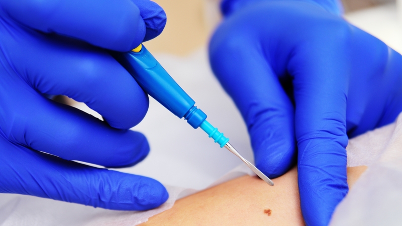 Viêm môi dị ứng là gì? Phương pháp điều trị viêm môi dị ứng 3