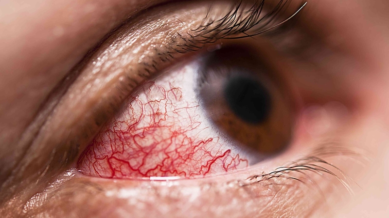 viem-mong-mat 1.jpeg