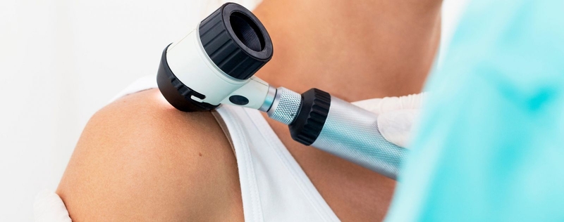 Viêm nang lông có tự hết không?2