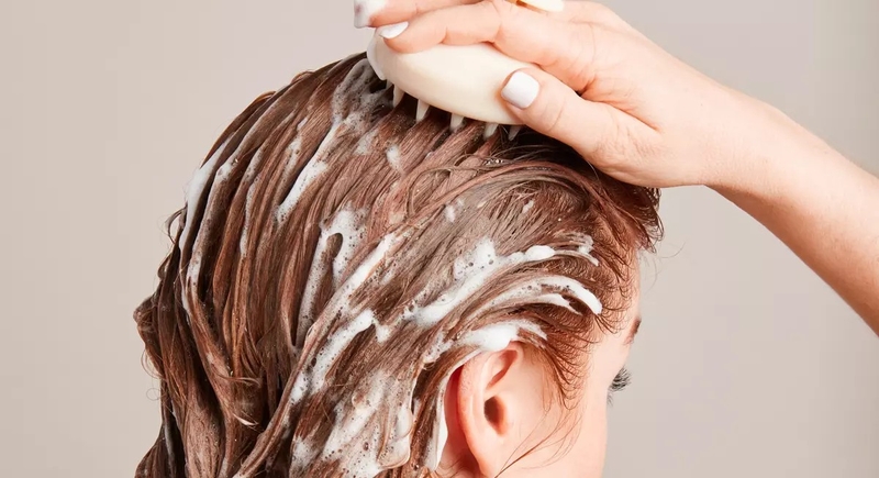 Viêm nang lông da đầu​ do đâu và cách điều trị? - 6