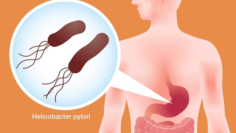 Viêm niêm mạc dạ dày và những điều cần biết 1