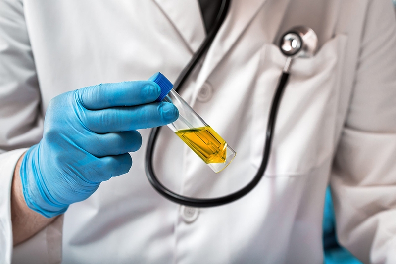 Viêm niệu đạo không do lậu có nguy hiểm không? 3