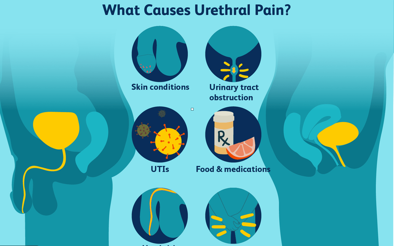 Viêm niệu đạo nữ có tự khỏi không? Điều trị như thế nào? 2