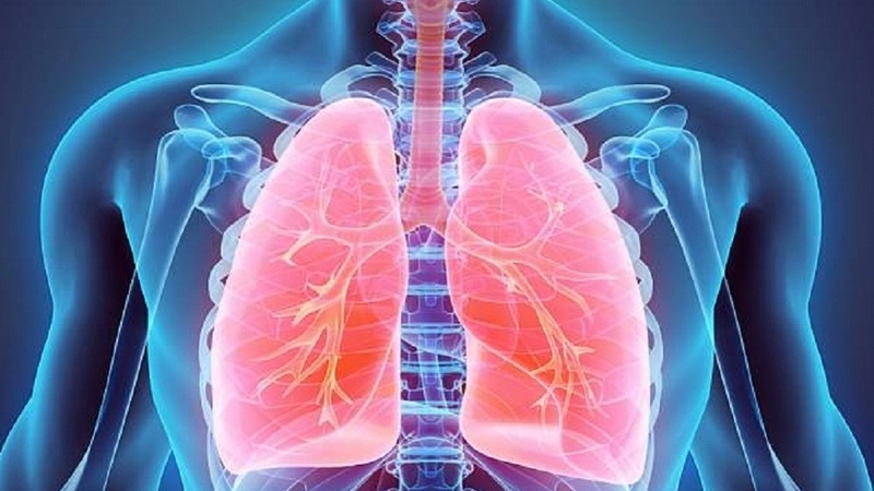 Viêm phế quản cấp j20 là gì? Triệu chứng bệnh ra sao? 1