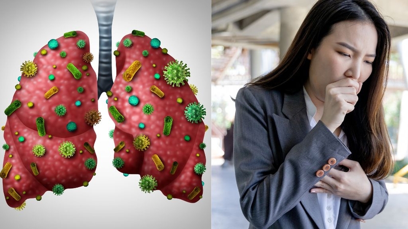 Viêm phế quản có nguy hiểm không? Điều trị ra sao? 2