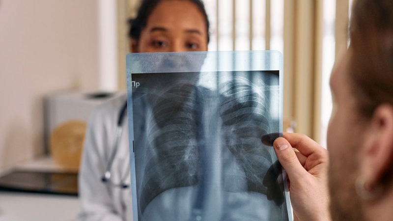 Bảo vệ đường hô hấp giúp giảm nguy cơ mắc viêm phế quản