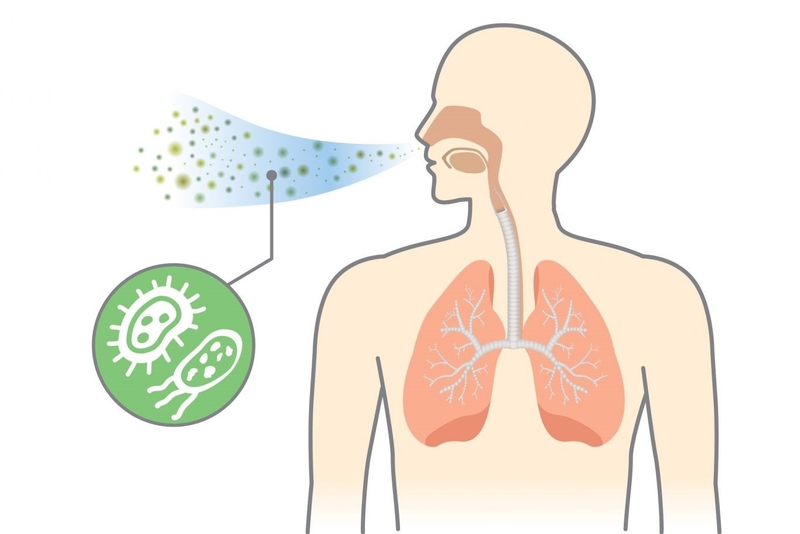 Viêm phổi cộng đồng ở người lớn: Giải đáp các câu hỏi thường gặp cùng bác sĩ Nguyễn Văn My 1