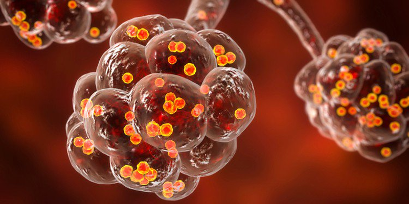 Viêm phổi hoại tử có nguy hiểm không? Nguyên nhân, triệu chứng và cách phòng ngừa bệnh 3