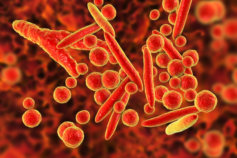 Viêm phổi nặng ở trẻ em: Nguyên nhân, triệu chứng, hướng điều trị và chăm sóc 1