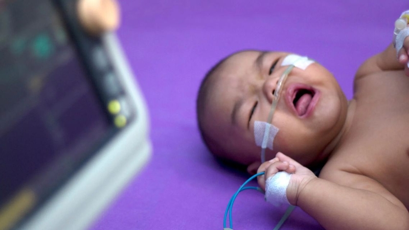 Viêm phổi ở trẻ sơ sinh: Nguyên nhân, triệu chứng, cách điều trị 3