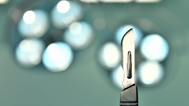 Viêm phúc mạc cấp: Nguyên nhân, triệu chứng và các bước điều trị 3