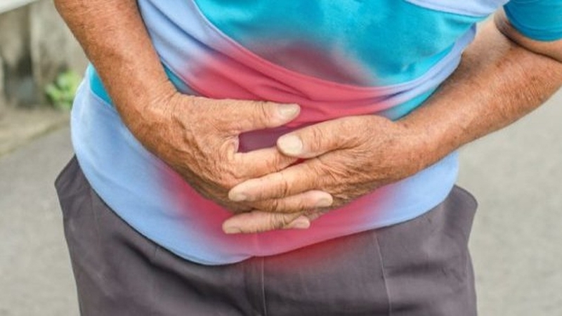 Viêm phúc mạc thứ phát: Nguyên nhân và cách điều trị bệnh hiệu quả 1