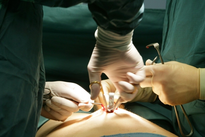 Viêm ruột thừa có phải mổ không? Các phương pháp phẫu thuật thường được sử dụng 2